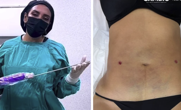 “Chips sexuales” y liposucciones en 14 mil pesos: el polémico catálogo de la clínica Detox donde desapareció Blanca Adriana