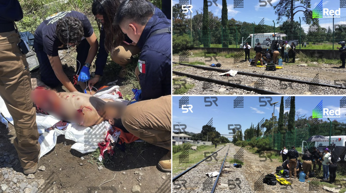 Víctima arrollada por tren en Amalucan sobrevive con amputaciones y lesiones graves